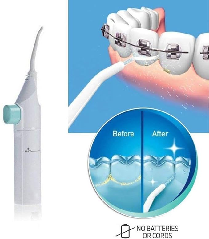 Dental Water Flosser - RashidExpress