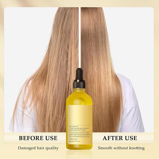 Hair Growth Oil - RashidExpress