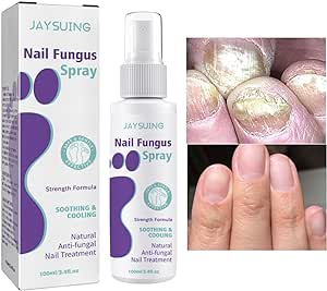 Nail Fungus Spray - RashidExpress