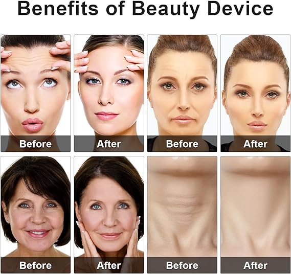 Eye Beauty Device - RashidExpress