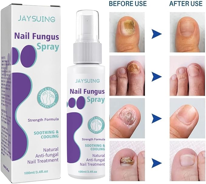 Nail Fungus Spray - RashidExpress