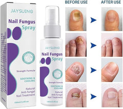 Nail Fungus Spray - RashidExpress