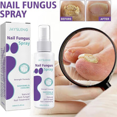 Nail Fungus Spray - RashidExpress