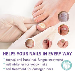 Nail Fungus Spray - RashidExpress