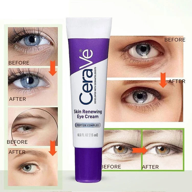 Skin Renewing Eye Cream - RashidExpress