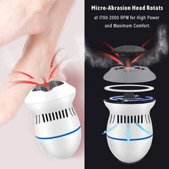 Electric Callus Remover - RashidExpress